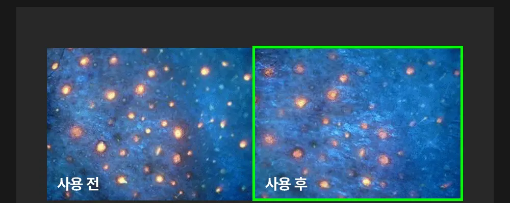 [피지연화제] 메디필 엑스트라 슈퍼9 플러스 3X 250ml 기획 (+스크래퍼+화장솜 40매) 상세페이지 21
